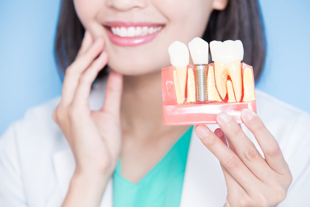 Woman Dentist Take Implant Tooth